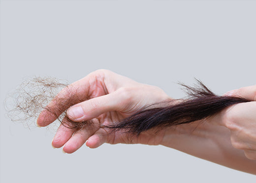 The Most Common Causes For Hair Fall